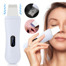 Peeling Ultrassônico para Rosto