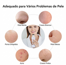 Peeling Ultrassônico para Rosto